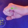TORCICOLLO E  SHIATSU